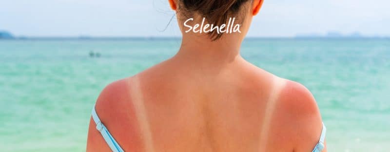3 rimedi contro le scottature solari - Il Blog di Selenella